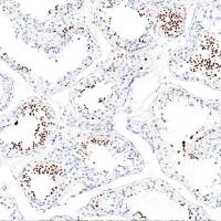 中杉金桥  ZA-0671  睾丸核蛋白（NUT）抗体试剂（免疫组织化学法）