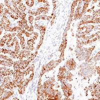 中杉金桥 ZA-0668 BRAF V600E蛋白 抗体试剂(免疫组织化学)