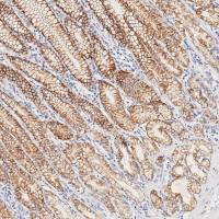 中杉金桥 ZA-0674 Claudin18.2抗体试剂(免疫组织化学)