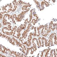 中杉金桥  ZA-0673  Brg1抗体试剂（免疫组织化学）