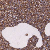 鼠抗人胶质纤维酸性蛋白单克隆抗体  TDCGM-0153