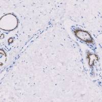 兔抗人FOXA1单克隆抗体  TDCFR-0051