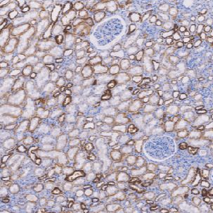 鼠抗人肾特异性钙粘附蛋白单克隆抗体  TDCKM-0040