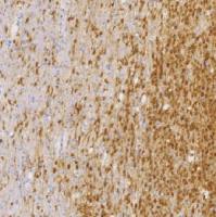 鼠抗人IDH1单克隆抗体  TDCIM-0190