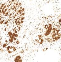 鼠抗人MGMT单克隆抗体  TDCMM-0161