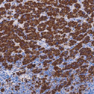 鼠抗人干细胞特异性抗原单克隆抗体  TDCHM-0270