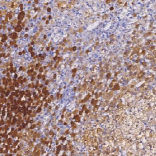 鼠抗人抑制素α单克隆抗体  TDCIM-0151
