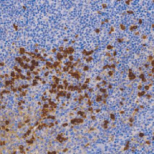 兔抗人免疫球蛋白A单克隆抗体  TDCIR-0100