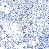 兔抗人生长激素单克隆抗体  TDCHR-0201