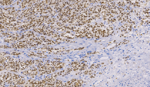 鼠抗人MiTF单克隆抗体 TDCMM-0170