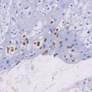鼠抗人乳头瘤病毒16单克隆抗体  TDCHM-0260