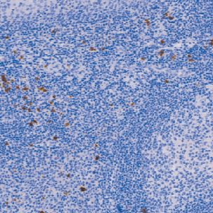 鼠抗人免疫球蛋白G4单克隆抗体  TDCIM-0130