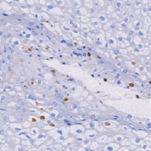 鼠抗人乳头瘤病毒(广谱)单克隆抗体  TDCHM-0257