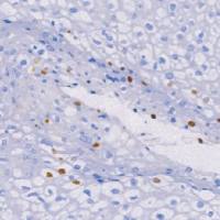 鼠抗人乳头瘤病毒(广谱)单克隆抗体  TDCHM-0257