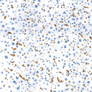 鼠抗人巨噬细胞单克隆抗体  TDCMM-0100