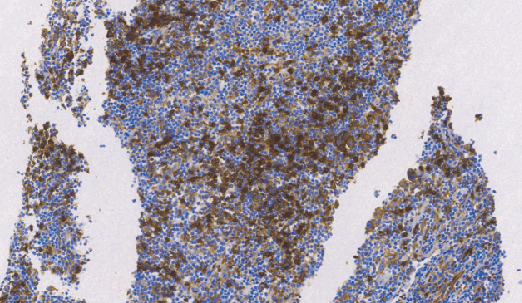 兔抗人HLA-DR α链单克隆抗体 TDCHR-0300