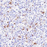 中杉金桥  ZG-0601  CXCL-13抗体试剂（免疫组织化学）