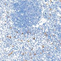 鼠抗人朗格素单克隆抗体  TDCLM-0030