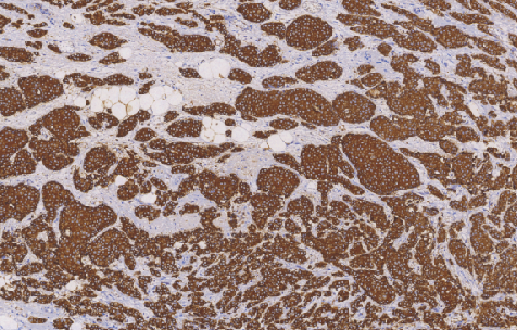 鼠抗人粘液素糖蛋白1单克隆抗体 TDCMM-0250