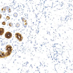 兔抗人乳腺球蛋白单克隆抗体  TDCMR-0111