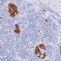 鼠抗人胰岛素单克隆抗体 TDCIM-0170