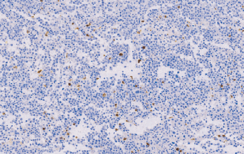 兔抗人髓过氧化物酶多克隆抗体 TDCMR-0211