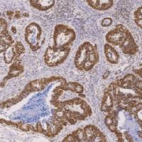 鼠抗人错配修复蛋白1单克隆抗体  TDCMM-0182