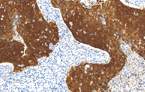 鼠抗人热休克蛋白27单克隆抗体  TDCHM-0150