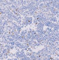 兔抗人髓过氧化物酶多克隆抗体  TDCMR-0211