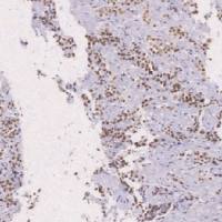 鼠抗人INI-1单克隆抗体 TDCIM-0160