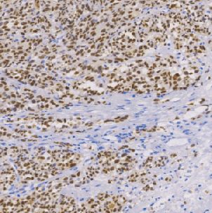 鼠抗人MiTF单克隆抗体 TDCMM-0170