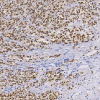 鼠抗人MiTF单克隆抗体  TDCMM-0170