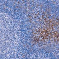 兔抗人LEF1单克隆抗体  TDCLR-0080