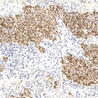 鼠抗人MDM2蛋白单克隆抗体  TDCMM-0121