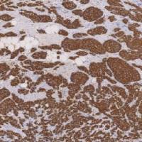 鼠抗人粘液素糖蛋白1单克隆抗体  TDCMM-0250