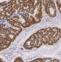 鼠抗人错配修复蛋白6单克隆抗体  TDCMM-0202