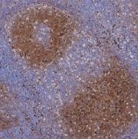 鼠抗人λ轻链单克隆抗体 TDCLM-0010