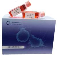 U-Ch1 人骶骨脊索瘤细胞/U-Ch1/U-Ch1细胞/UCh1细胞/UCh1/STR鉴定/镜像绮点（Cellverse）