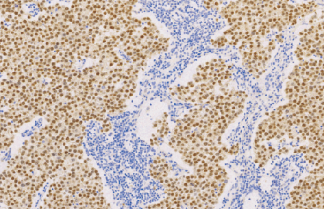 兔抗人八聚体结合转录因子4单克隆抗体 TDCOR-0021