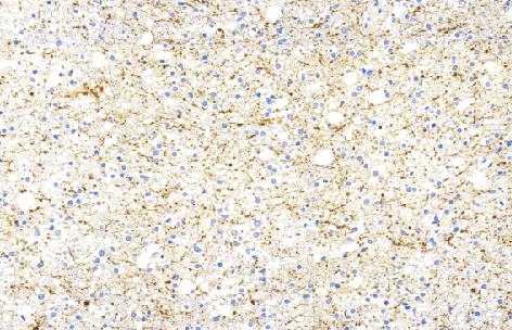 鼠抗人神经丝蛋白抗体单克隆抗体  TDCNM-0050