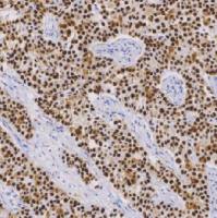 鼠抗人p53蛋白单克隆抗体 TDCPM-0142