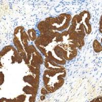 鼠抗人前列腺酸性磷酸酶单克隆抗体  TDCPM-0220