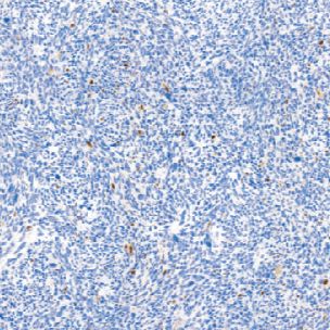鼠抗人肌细胞生成素单克隆抗体  TDCMM-0340