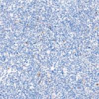 鼠抗人肌细胞生成素单克隆抗体  TDCMM-0340