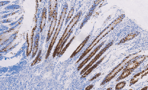 鼠抗人粘液素糖蛋白2单克隆抗体 TDCMM-0261