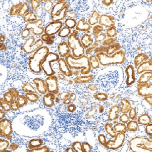 鼠抗人Napsin A单克隆抗体  TDCNM-0012