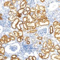 鼠抗人Napsin A单克隆抗体  TDCNM-0012