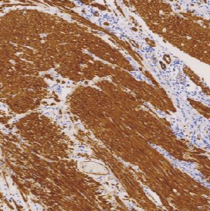 鼠抗人肌球蛋白重链（平滑肌）单克隆抗体  TDCMM-0360