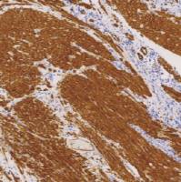 鼠抗人肌球蛋白重链(平滑肌)单克隆抗体 TDCMM-0360