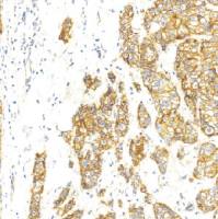 兔抗人p120单克隆抗体  TDCPR-0181